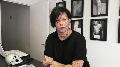 Tatouage Raté De Son œil Laurence Debal Déplore Une Peine